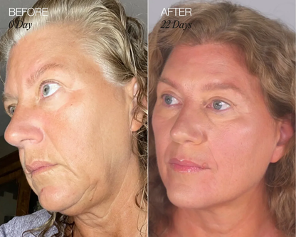 Lymphatic Face Brush