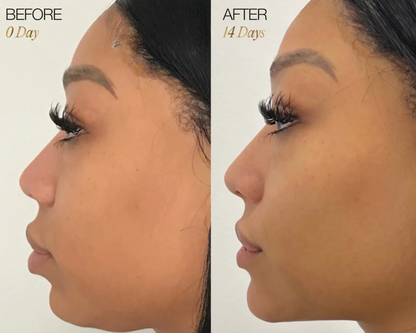 Lymphatic Face Brush