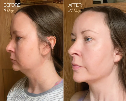 Lymphatic Face Brush