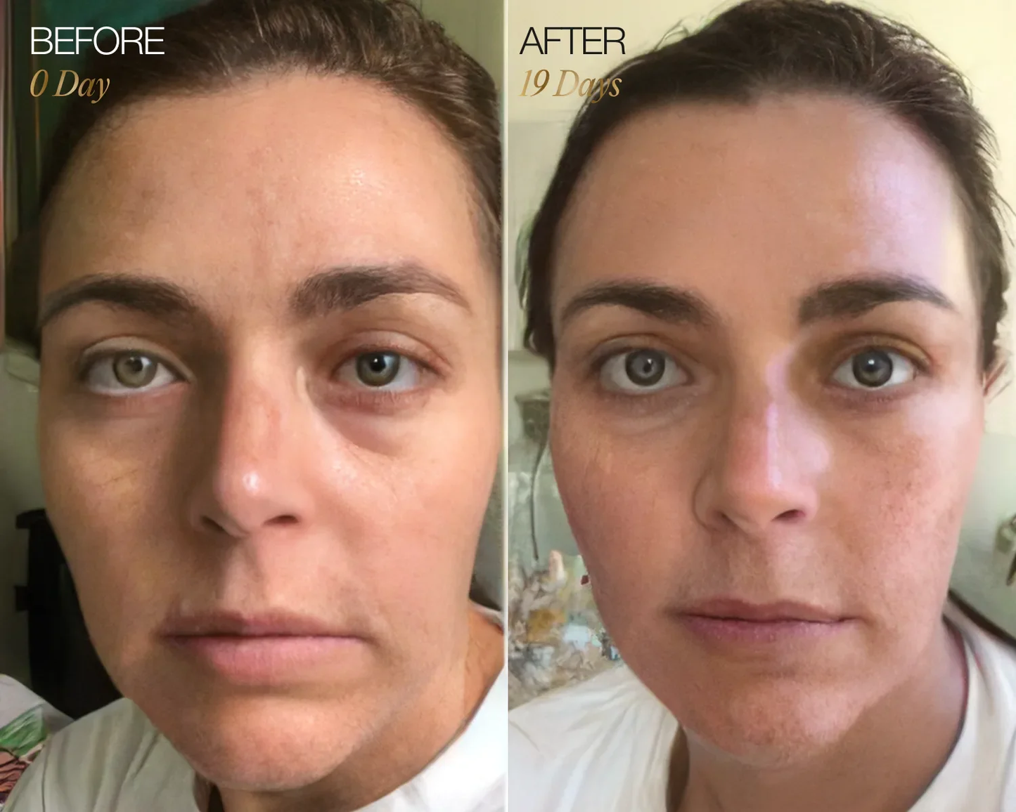 Lymphatic Face Brush