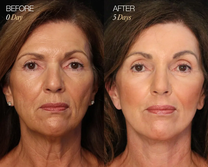 Lymphatic Face Brush