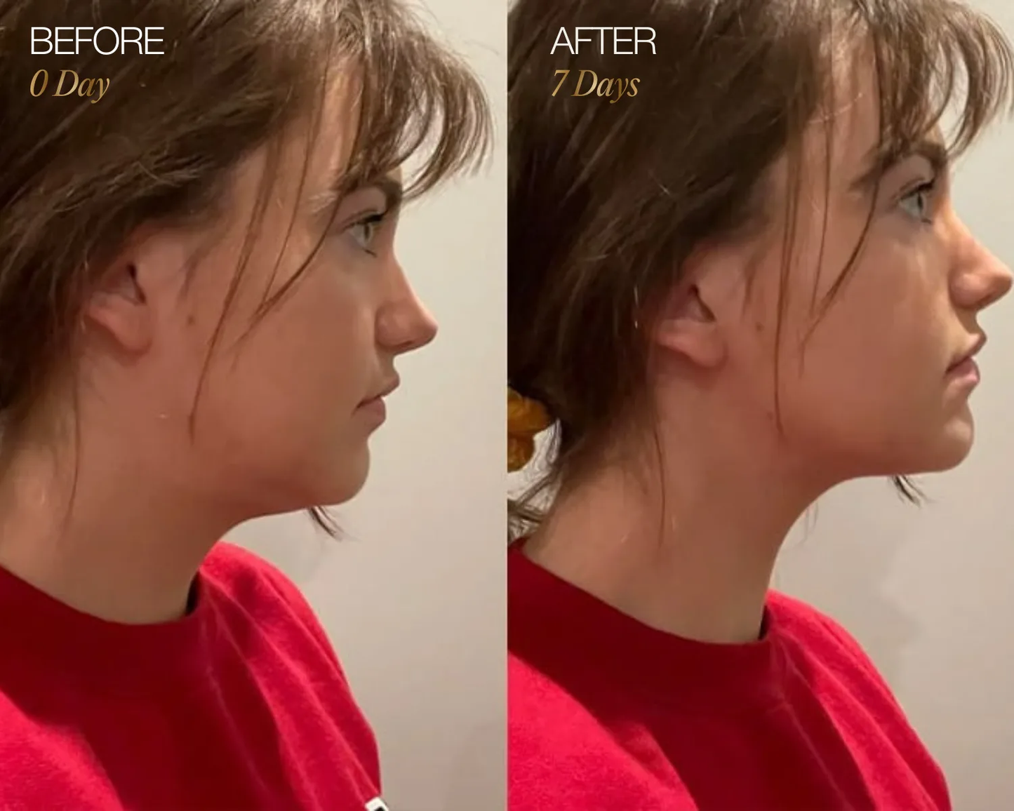 Lymphatic Face Brush